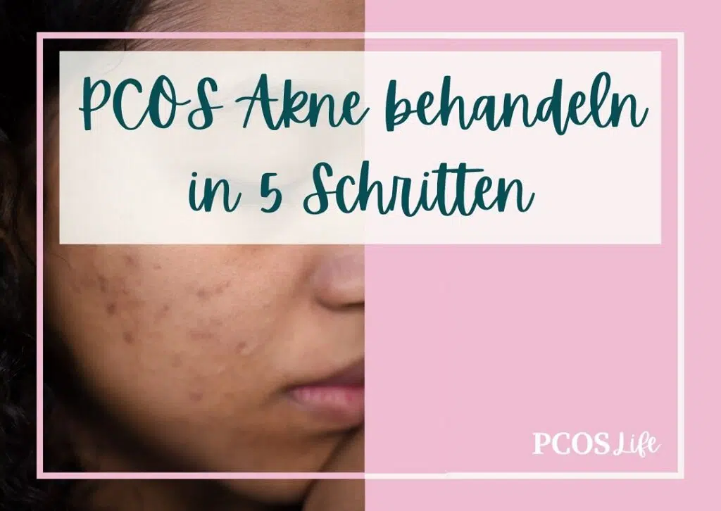 PCOS Akne behandeln in 5 Schritten: Der Guide zu reiner Haut