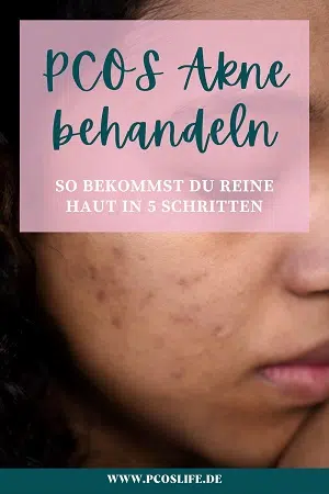 Reine Haut trotz PCO-Syndrom: PCOS Akne behandeln in 5 Schritten | Pinterest Pin