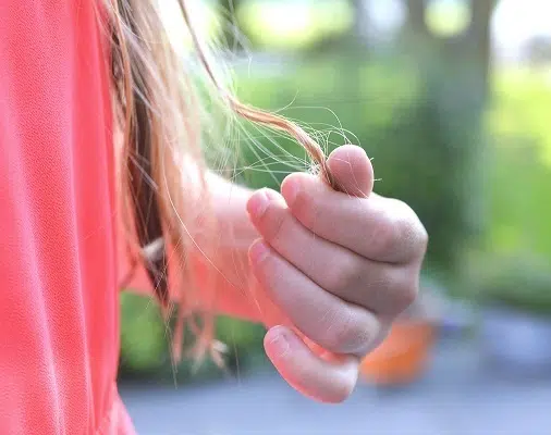 Eines der belastendsten Symptome bei PCOS ist Haarausfall.